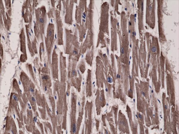  IHC resultImmunohistochemical staining of formalin fixed and paraffin embedded human heart tissue sections using Anti-Acetyl CoA Carboxylase 1 RM232 at a 1:300 dilution