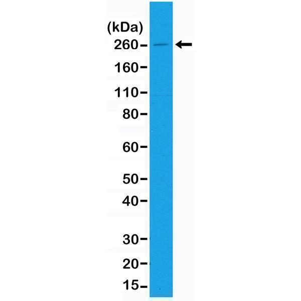  Western Blotting resultWestern Blot of A431 cell lysates using Anti-Acetyl CoA Carboxylase 1 (RM232) at a 1:1,000 dilution, showed a band of Acetyl CoA Carboxylase 1 (~260 kDa) expressed in A431 cells