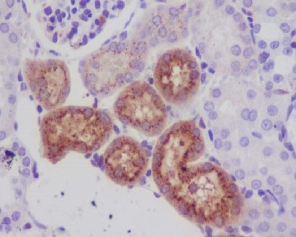 M01811 LYZ primary antibodies IHC testing 1