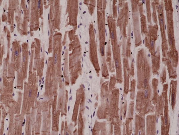  IHC resultImmunohistochemical staining of formalin fixed and paraffin embedded human heart tissue sections using Anti-Desmin RM234 at a 1:4000 dilution