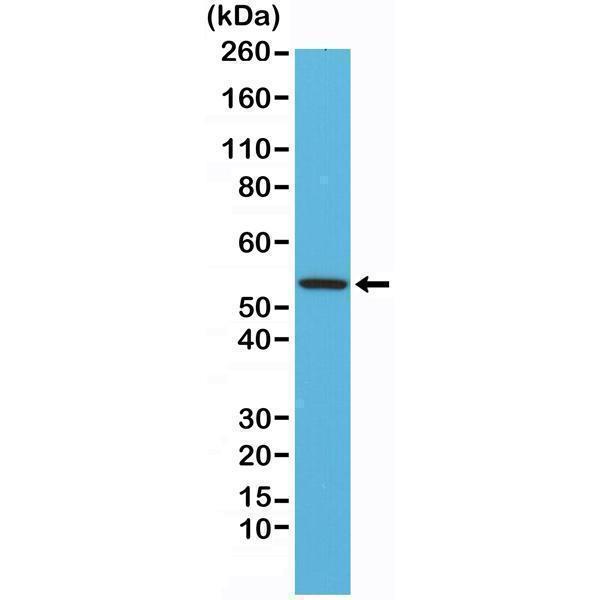  Western Blotting resultWestern Blot of mouse heart tissue lysates using Anti-Desmin RM234 at a 1:1000 dilution, showed a band of Desmin (~54 kDa) expressed in mouse heart