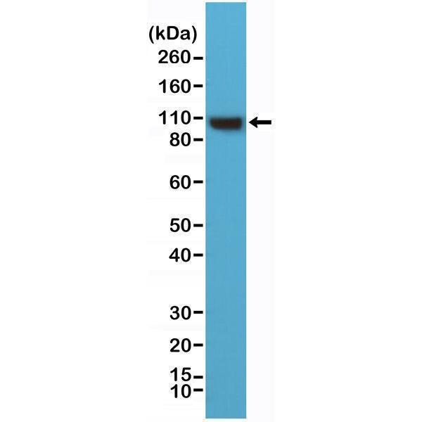  Western Blotting resultWestern Blot of HeLa cells lysates using anti-alpha-Actinin-4 rabbit monoclonal antibody (clone RM287) at a 1:1000 dilution