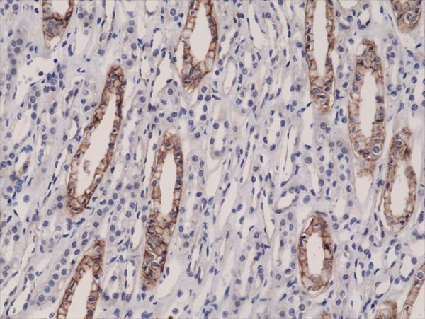  IHC resultImmunohistochemical staining of formalin fixed and paraffin embedded human kidney tissue sections using Anti-JAM1 Rabbit Monoclonal Antibody (Clone RM275) at a 1:10000 dilution