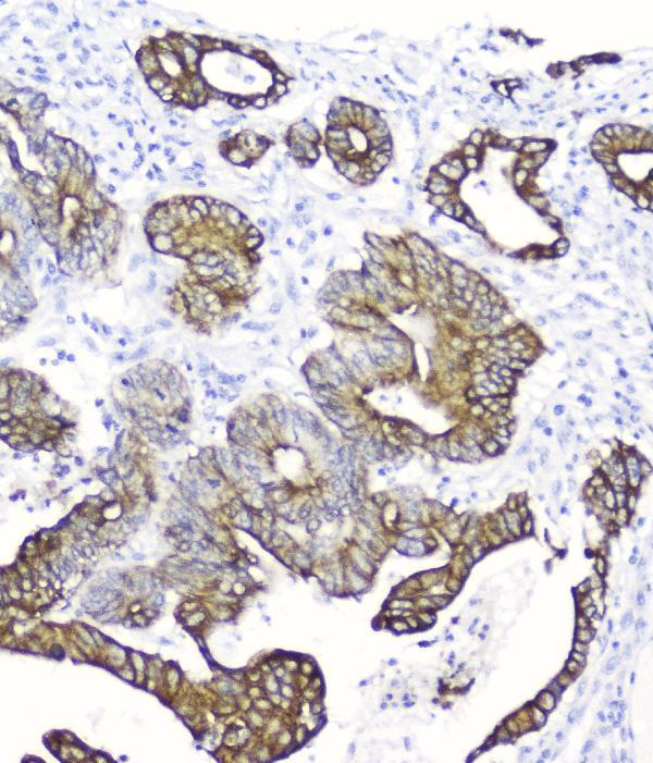 M02101 2 Cytokeratin_19 primary antibodies IHC testing 2_1