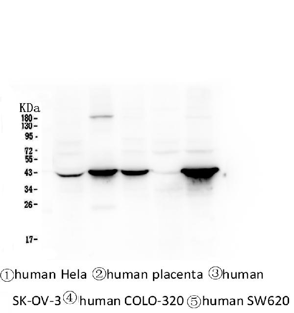 Western blot analysis of Cytokeratin 19 using anti-Cytokeratin 19 antibody (M02101-2). Electrophoresis was performed on a 5-20% SDS-PAGE gel at 70V (Stacking gel) / 90V (Resolving gel) for 2-3 hours. The sample well of each lane was loaded with 50ug of sample under reducing conditions. Lane 1: human Hela whole cell lysates, Lane 2: human placenta tissue lysates, Lane 3: human SK-OV-3 whole cell lysates, Lane 4: human COLO-320 whole cell lysates. After Electrophoresis, proteins were transferred to a Nitrocellulose membrane at 150mA for 50-90 minutes. Blocked the membrane with 5% Non-fat Milk/ TBS for 1.5 hour at RT. The membrane was incubated with mouse anti-Cytokeratin 19 antigen affinity purified monoclonal antibody (Catalog # M02101-2) at 0.5 μg/mL overnight at 4°C, then washed with TBS-0.1%Tween 3 times with 5 minutes each and probed with a goat anti-mouse IgG-HRP secondary antibody at a dilution of 1:10000 for 1.5 hour at RT. The signal is developed using an Enhanced Chemiluminescent detection (ECL) kit (Catalog # EK1001) with Tanon 5200 system.