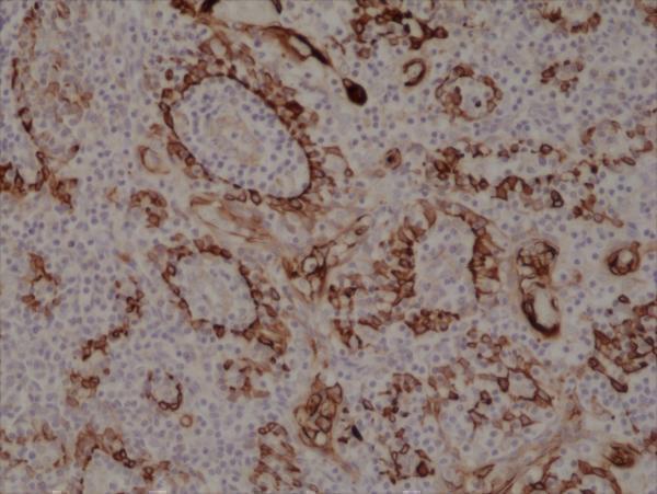 M02101 3 IHC test result image 2
