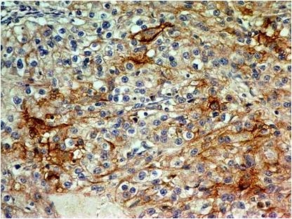 M02120 Immunostaining Analysis IHC
