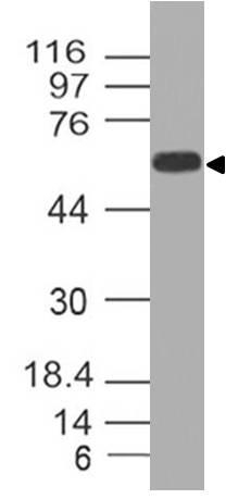 Western blot analysis of CD73
