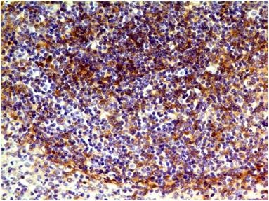 Immunohistochemical analysis of CD73 in human Spleen using CD73 antibody (Clone: ABM40E2) at 5 µg/ml