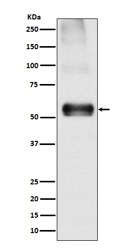 Western blot analysis of EAAT1 expression in Mouse brain lysate