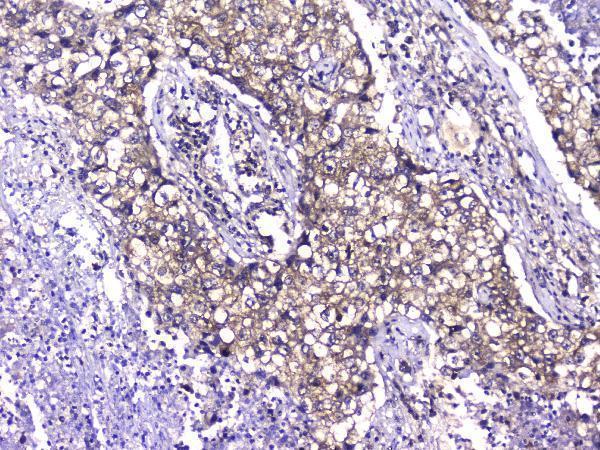 M02389 TCP1_alpha primary antibodies IHC testing 2_1