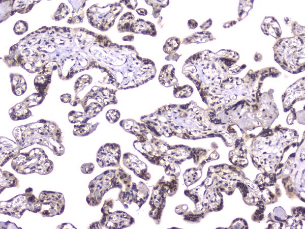IHC analysis of TCP1 alpha using anti-TCP1 alpha antibody (M02389). TCP1 alpha was detected in paraffin-embedded section of human placenta tissue. Heat mediated antigen retrieval was performed in citrate buffer (pH6, epitope retrieval solution) for 20 mins. The tissue section was blocked with 10% goat serum. The tissue section was then incubated with 2μg/ml mouse anti-TCP1 alpha Antibody (M02389) overnight at 4°C. Biotinylated goat anti-mouse IgG was used as secondary antibody and incubated for 30 minutes at 37°C. The tissue section was developed using Strepavidin-Biotin-Complex (SABC)(Catalog # SA1021) with DAB as the chromogen.