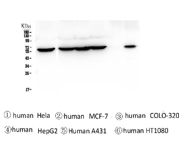 Western blot analysis of TCP1 alpha using anti-TCP1 alpha antibody (M02389). Electrophoresis was performed on a 5-20% SDS-PAGE gel at 70V (Stacking gel) / 90V (Resolving gel) for 2-3 hours. The sample well of each lane was loaded with 50ug of sample under reducing conditions. Lane 1: human Hela whole cell lysates, Lane 2: human MCF-7 whole cell lysates, Lane 3: human COLO-320 whole cell lysates, Lane 4: human HepG2 whole cell lysates, Lane 5: human A431 whole cell lysates, Lane 6: human HT1080 whole cell lysates. After Electrophoresis, proteins were transferred to a Nitrocellulose membrane at 150mA for 50-90 minutes. Blocked the membrane with 5% Non-fat Milk/ TBS for 1.5 hour at RT. The membrane was incubated with mouse anti-TCP1 alpha antigen affinity purified monoclonal antibody (Catalog # M02389) at 0.5 μg/mL overnight at 4°C, then washed with TBS-0.1%Tween 3 times with 5 minutes each and probed with a goat anti-mouse IgG-HRP secondary antibody at a dilution of 1:10000 for 1.5 hour at RT. The signal is developed using an Enhanced Chemiluminescent detection (ECL) kit (Catalog # EK1001) with Tanon 5200 system.
