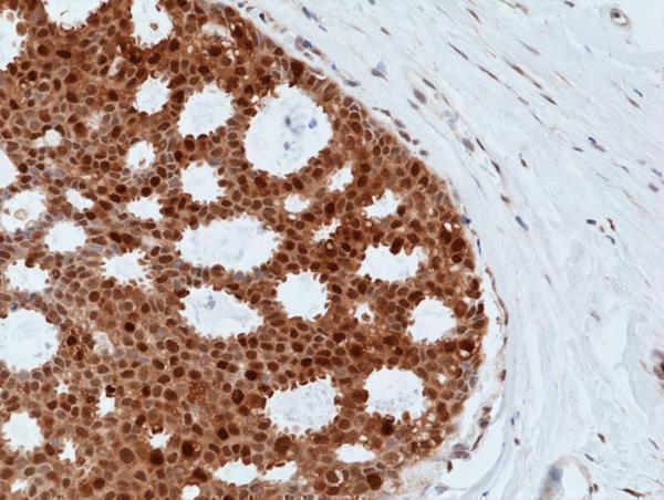 M02423 1 IHC test result image 2