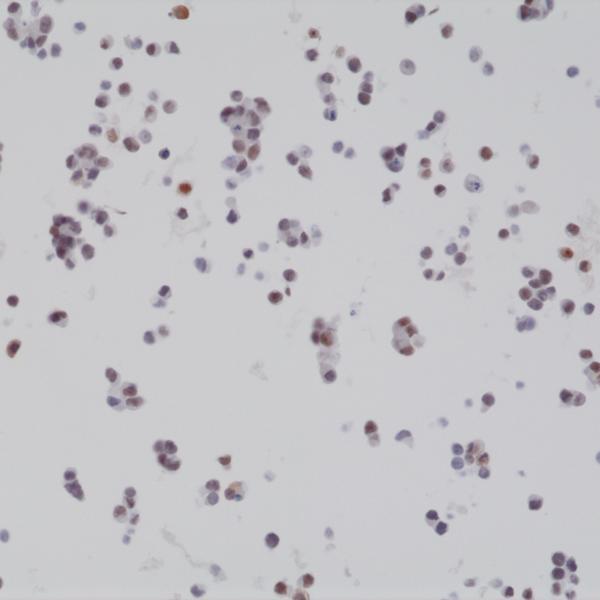 M02423 IHC test result image 2