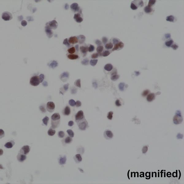 M02423 IHC test result image 3