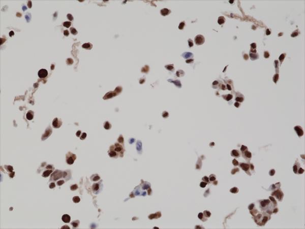 M02423 IHC test result image 4