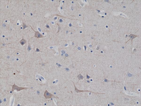 M02482 5 IHC test result image 2