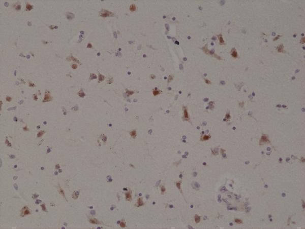  IHC resultImmunohistochemical staining of formalin fixed and paraffin embedded human brain tissue section using anti-SATB2 rabbit monoclonal antibody (Clone RM365) at a 1:200 dilution