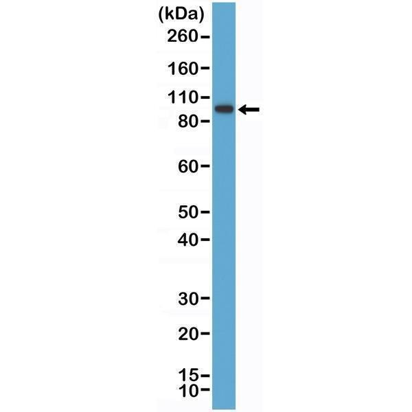 Western Blotting resultWestern Blot of K562 cell lysate using anti-SATB2 rabbit monoclonal antibody (Clone RM365) at a 1:1000 dilution