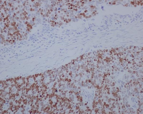 M02588 SATB2 primary antibodies IHC testing 1