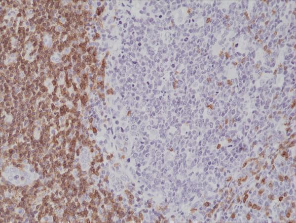  IHC resultImmunohistochemical staining of formalin fixed and paraffin embedded human tonsil tissue section using anti-CD5 rabbit monoclonal antibody (Clone RM314) at a 1:1000 dilution