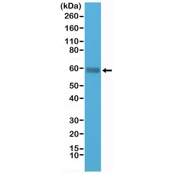  Western Blotting resultWestern Blot of Jurkat cells lysate using anti-CD5 rabbit monoclonal antibody (Clone RM314) at a 1:1000 dilution