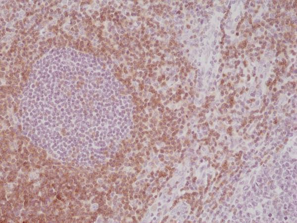  IHC resultImmunohistochemical staining of formalin fixed and paraffin embedded human tonsil tissue section using anti-CD5 rabbit monoclonal antibody (Clone RM354) at a 1:500 dilution