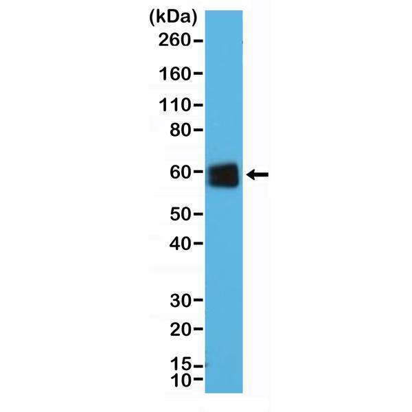  Western Blotting resultWestern Blot of Jurkat cells lysate using anti-CD5 rabbit monoclonal antibody (Clone RM354) at a 1:25000 dilution