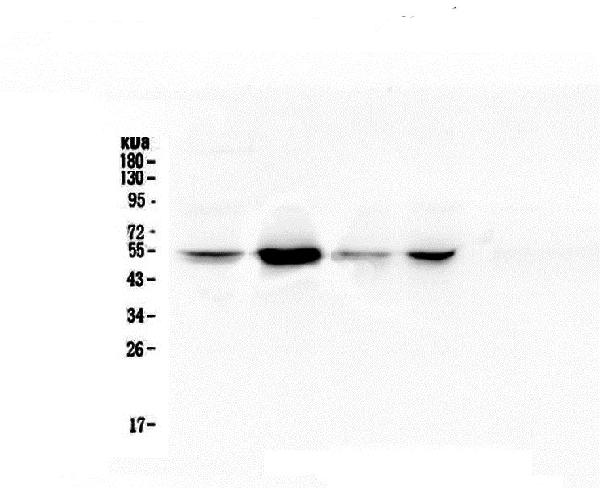 Western blot analysis of RbAp48 using anti-RbAp48 antibody (M02702-1). Electrophoresis was performed on a 10% SDS-PAGE gel at 70V (Stacking gel) / 90V (Resolving gel) for 2-3 hours. The sample well of each lane was loaded with 50ug of sample under reducing conditions. Lane 1: human A549 whole cell lysate, Lane 2: human Jurkat whole cell lysate, Lane 3: human Hela whole cell lysate, Lane 4: human PANC-1 whole cell lysate. After Electrophoresis, proteins were transferred to a Nitrocellulose membrane at 150mA for 50-90 minutes. Blocked the membrane with 5% Non-fat Milk/ TBS for 1.5 hour at RT. The membrane was incubated with mouse anti-RbAp48 antigen affinity purified monoclonal antibody (Catalog # M02702-1) at 0.5 μg/mL overnight at 4°C, then washed with TBS-0.1%Tween 3 times with 5 minutes each and probed with a goat anti-mouse IgG-HRP secondary antibody at a dilution of 1:10000 for 1.5 hour at RT. The signal is developed using an Enhanced Chemiluminescent detection (ECL) kit (Catalog # EK1001) with Tanon 5200 system.