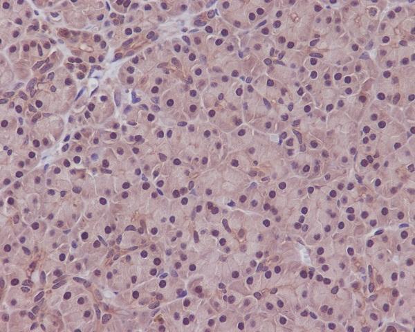 Immunohistochemical analysis of paraffin-embedded human pancreas, using PPP1CA+PPP1CB Antibody(M02801)PPP1CA was detected in paraffin-embedded tissue section