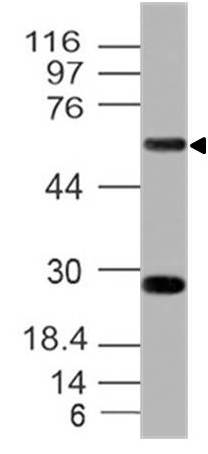 Western blot analysis of hCD39