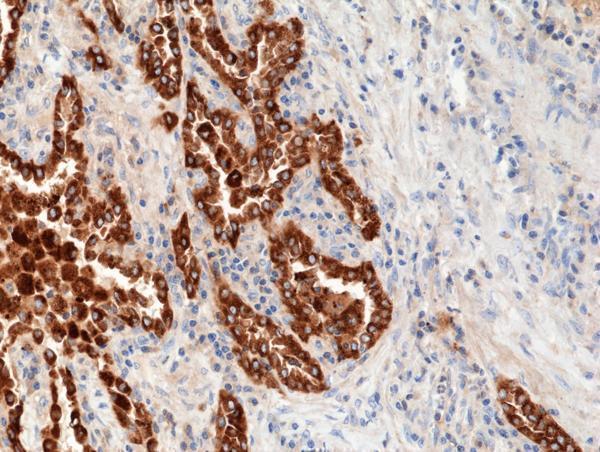 M03441 IHC test result image 2