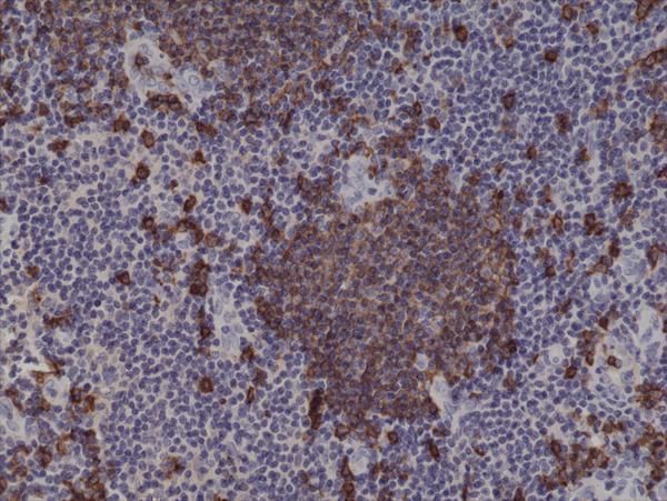 M03780 2 IHC test result image 2