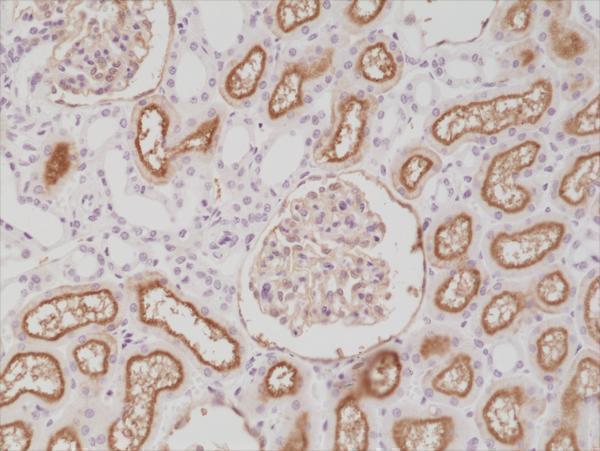 M04065 2 IHC test result image 2
