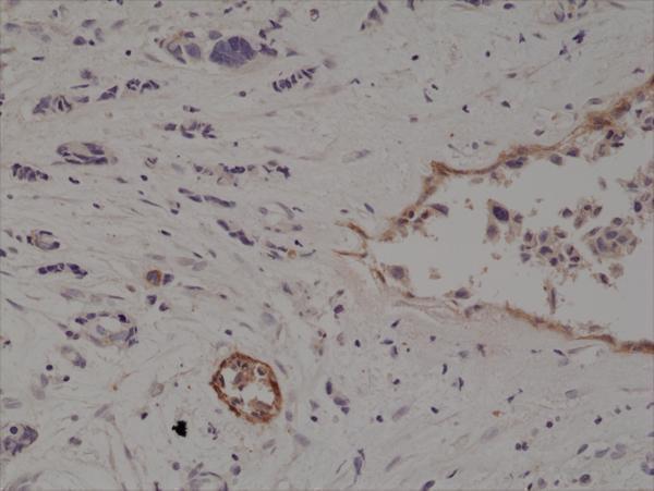 M04065 2 IHC test result image 3