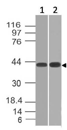 Western blot analysis of TSLP Receptor