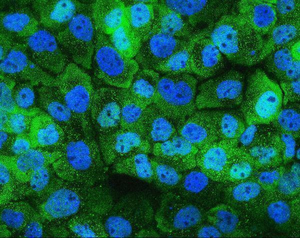 M04168 1 HSPH1 primary antibodies IF testing 5