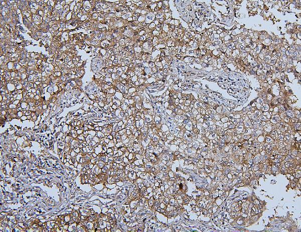  IHC analysis of HSPH1 using anti-HSPH1 antibody (M04168-1)