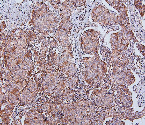  IHC analysis of HSPH1 using anti-HSPH1 antibody (M04168-1)