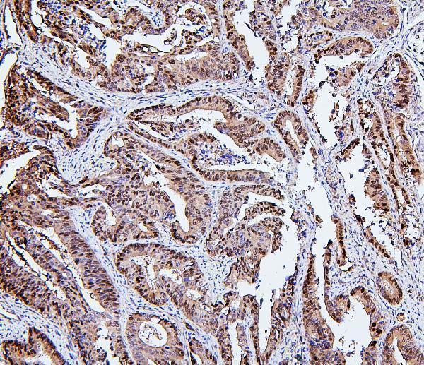 M04168 1 HSPH1 primary antibodies IHC testing 4