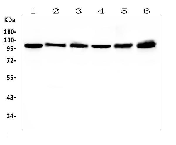 Western blot analysis of HSPH1 using anti-HSPH1 antibody (M04168-1)