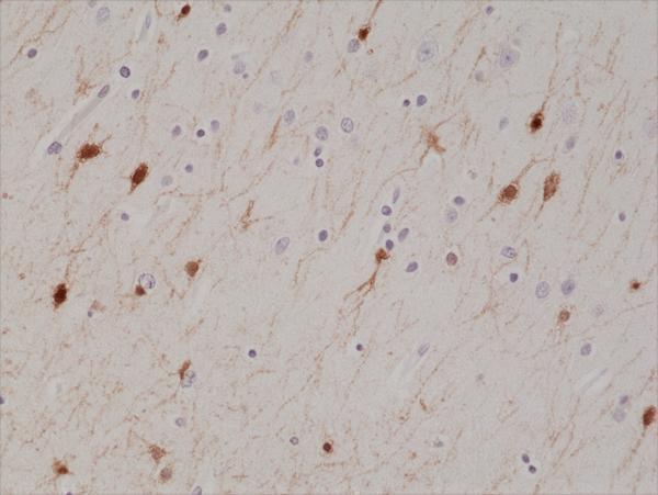 M04255 5 IHC test result image 2