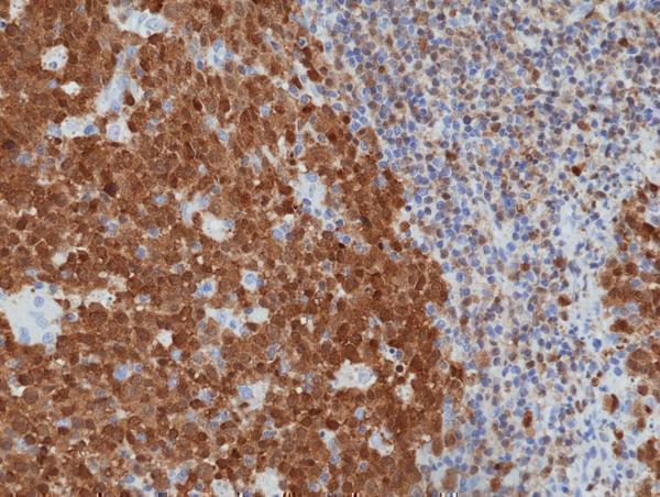  IHC resultImmunohistochemical staining of formalin fixed and paraffin embedded human tonsil tissue section using anti-BOB-1/OBF-1 rabbit monoclonal antibody (Clone RM378) at a 1:1250 dilution