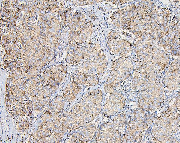  IHC analysis of COPE using anti-COPE antibody (M04544)