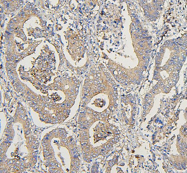 M04544 COPE primary antibodies IHC testing 4