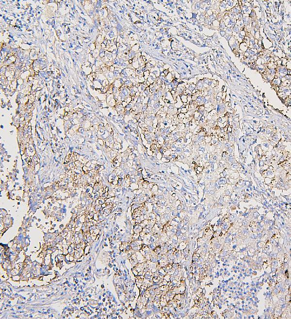 M04544 COPE primary antibodies IHC testing 5