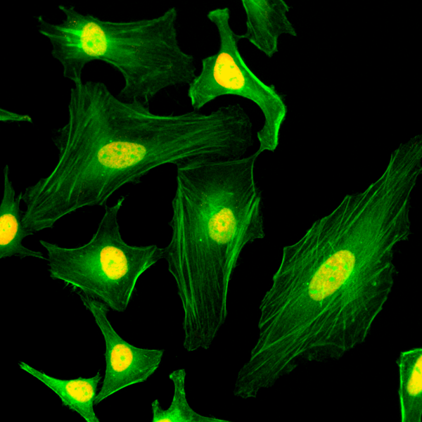 Figure 2. ICC result Immunocytochemistry of HeLa cells, using anti-Histone macroH2A1 Rabbit mAb RM248 (red). Actin filaments have been labeled with fluorescein phalloidin (green).