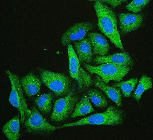 M04773 Cofilin 2 primary antibodies IF testing 7