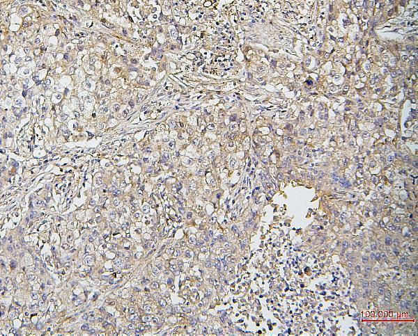  IHC analysis of Cofilin-2 using anti-Cofilin-2 antibody (M04773)